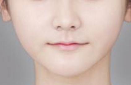 呼和浩特鼻部整形有哪些醫(yī)院可以信賴？為您推薦理想選擇