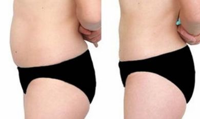 沈陽醫(yī)大一院醫(yī)美，尋覓技術(shù)高超的大夫，暢談假體隆鼻案例！