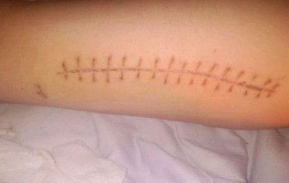 2023年長沙受歡迎的眼部整容醫(yī)師推薦