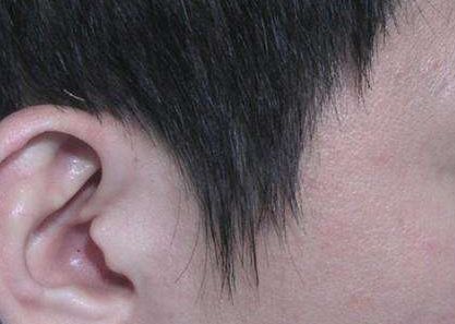 上海美容醫(yī)院盤點(diǎn)口碑排名，隆胸手術(shù)費(fèi)用公開曝光！