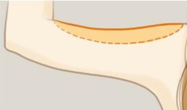 舟山市艾美醫(yī)學美容：楊誠、胡招兵醫(yī)生技術值得信賴嗎？他們的價目表如何？