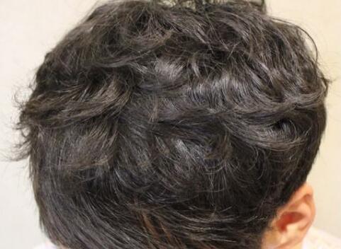 沈陽整形醫(yī)院哪家技術(shù)更先進(jìn)？有哪些正規(guī)醫(yī)美機(jī)構(gòu)？（附詳細(xì)價(jià)目表）