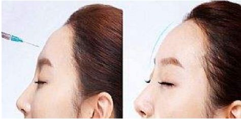 武漢雙眼皮最受歡迎的整形醫(yī)院排行榜前六！亞韓、中翰居前列為參考，看看哪家最贊！