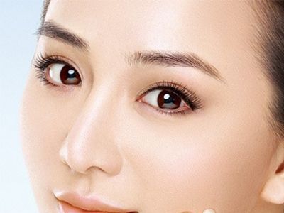 北京新星靚修復雙眼皮的技術效果如何？醫(yī)院案例現(xiàn)身