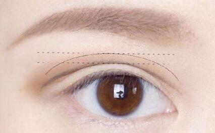 華中科技大學(xué)同濟醫(yī)學(xué)院附屬同濟醫(yī)院整形美容科：醫(yī)生技術(shù)究竟有何獨特之處？會帶來哪些效果？