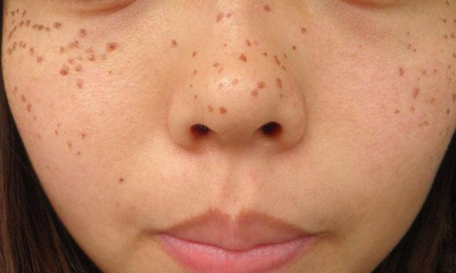 南京伊爾美醫(yī)療美容醫(yī)院真的可信嗎？有人分享他們的新醫(yī)院信息嗎？