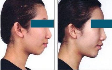 北京頂尖的整容專家排名揭曉！私人醫(yī)生榜單隆重公布