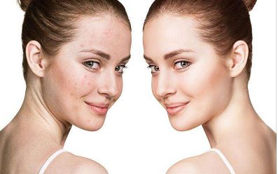 北京歐華醫(yī)院的楊小娟醫(yī)生手法評價(jià)，技術(shù)水平值得認(rèn)可！