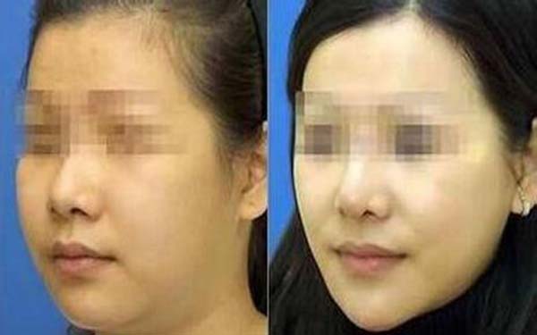 武漢至尚貝蓓好不好？2023價(jià)格表公布？興隆與變化，值得一試嗎？