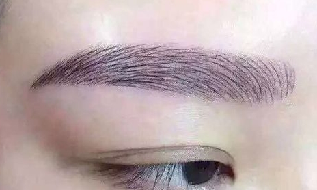 上海碧蓮盛植發(fā)醫(yī)院醫(yī)生技術(shù)如何？植發(fā)效果值得信賴嗎？