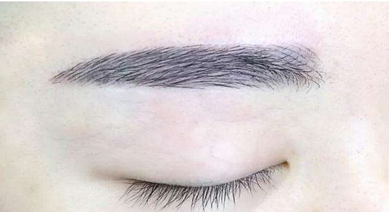 蘇州哪家醫(yī)院的拉皮除皺手術(shù)效果比較好？排名前五強(qiáng)公布