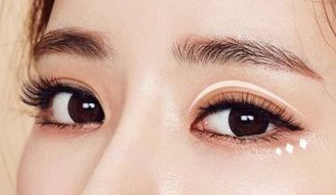 名師團隊加持，葉飛輪打造雙眼皮，成就有形雙眼美！