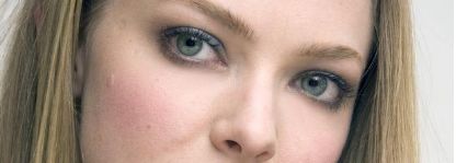 王醫(yī)生揭秘！湘雅附二實(shí)操雙眼皮術(shù)后成效公開！