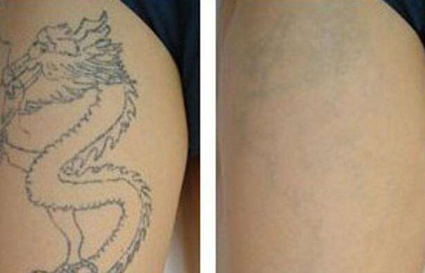 北京燒傷整形醫(yī)院排行榜：八大處、北醫(yī)三院齊名登榜