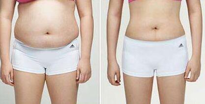 恩施奧萊做大拉皮有哪些效果？你知道嗎？