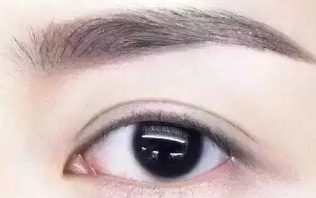 全國哪位專家值得信賴修復(fù)雙眼皮手術(shù)？頂級(jí)醫(yī)生排行榜首推名單揭曉