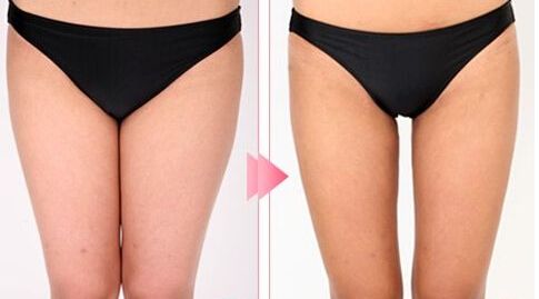 哈爾濱市十大雙眼皮整形醫(yī)生，絕對可信賴！