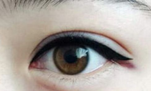 南京隆鼻術(shù)中高手脫穎而出！三位醫(yī)生實力強勁！