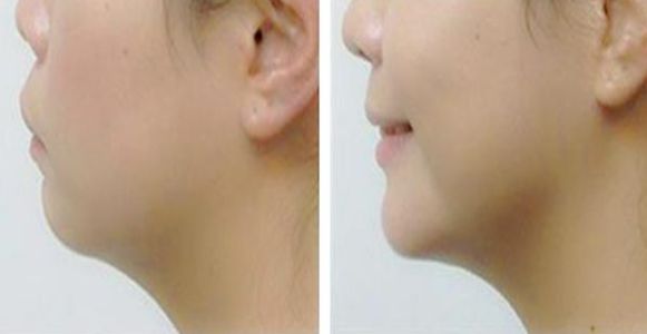 湘潭市哪家醫(yī)院擅長激光祛斑？丨激光美容科普分享