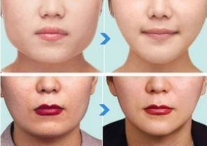 北京有哪些值得推薦的鼻整形醫(yī)生？年度五大鼻整形專家揭秘