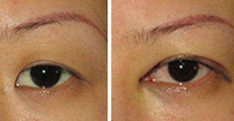 2023年北京專(zhuān)業(yè)處拉皮手術(shù)醫(yī)生推薦