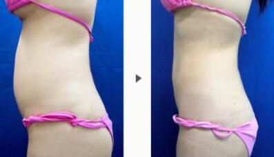 上海華美醫(yī)療美容整形醫(yī)院技術真的靠譜嗎？那里的醫(yī)生有經驗嗎？