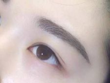 李炳澮醫(yī)生獨(dú)特的技術(shù) 手術(shù)風(fēng)格有何特點(diǎn)？并附帶隆鼻案例分析