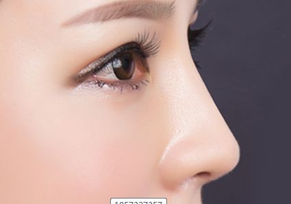 李天石磨骨費用公示與患者見證，現(xiàn)網(wǎng)友分享醫(yī)師簡介！