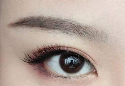 大連王琳雙眼皮的完美實踐，80天親身體驗揭秘