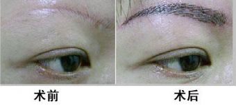 廣州哪家醫(yī)院靠譜？私立醫(yī)美口碑排行榜來襲！