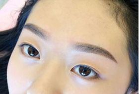 北京疤痕修復(fù)：首家成功研發(fā)創(chuàng)新技術(shù)的醫(yī)院匿名揭曉