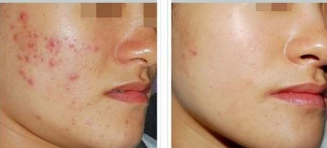 沈陽盛京醫(yī)院唇腭裂專家團隊及最新收費明細(xì)