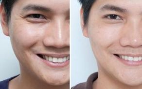 深圳整形醫(yī)院盛名鼎革，不容錯過！