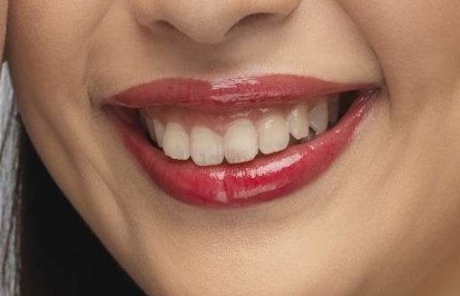 2023年北京近視手術(shù)高手引領(lǐng)潮流，瞿長(zhǎng)斌、林順潮、熊瑛等五位專(zhuān)家資料公開(kāi)！