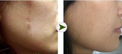 全國植發(fā)醫(yī)院排名揭曉！最值得信賴的連鎖機構(gòu)名單公開