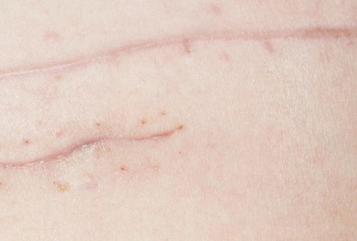 桂林華美醫(yī)院：胡凱鼻子整形前后效果大揭秘！看圖真相引人矚目