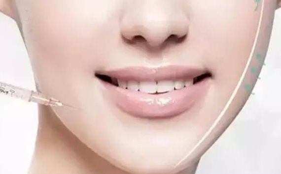 上海九院王健的雙眼皮手術(shù)效果如何？醫(yī)生經(jīng)驗(yàn)與成功案例分享