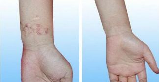 昆明最適合割雙眼皮的醫(yī)院是哪家？重點(diǎn)推薦的幾家醫(yī)院有哪些？