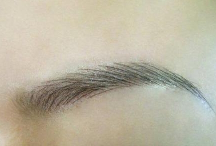 上海九院墊下巴誰的技術(shù)好？魏皎醫(yī)生真人案例和價格均價對比可信嗎？