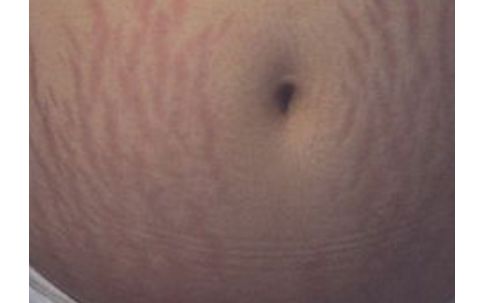 南昌佳美整形醫(yī)院：醫(yī)生團(tuán)隊(duì)強(qiáng)大，雙眼皮案例獨(dú)具匠心