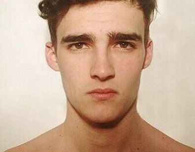 湘雅醫(yī)院龍劍虹的口碑如何？醫(yī)術(shù)出眾，附真實(shí)雙眼皮術(shù)后恢復(fù)圖！