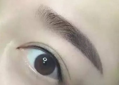 醫(yī)生楊明勇：從技術實力到用戶評價揭秘，提眉案例評價出乎預料！