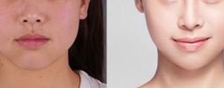 北京最具實力的植發(fā)醫(yī)院推薦，讓您了解八大處整形醫(yī)院植發(fā)費用與醫(yī)生水平