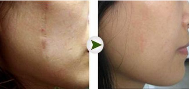 2023昆明地區(qū)頂級(jí)鼻部整形醫(yī)院排行榜揭曉！悉數(shù)解析各院隆鼻技術(shù)獨(dú)到之處