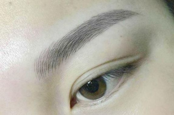 國內(nèi)公開的疤痕修復(fù)中心盤點(diǎn)，醫(yī)療美容聲譽(yù)不凡值得借鑒