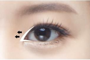 禪城區(qū)中心醫(yī)院整形科成功改變徐威強(qiáng)下頜角，告別「方姐」稱號(hào)！