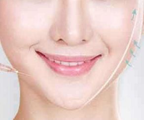 大坪醫(yī)院金絲骨針術(shù)醫(yī)師值得推薦，服務(wù)價(jià)格一覽無余！