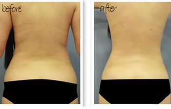 北京哪位醫(yī)生在八大處進行隆胸手術(shù)較為專業(yè)？