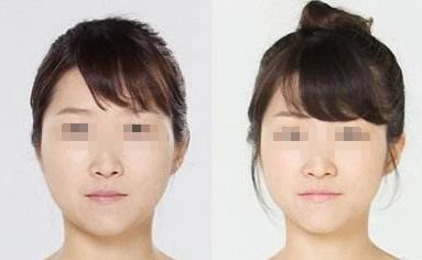 廣州哪家醫(yī)院能夠有效除皺？詳細介紹醫(yī)院基本情況分享