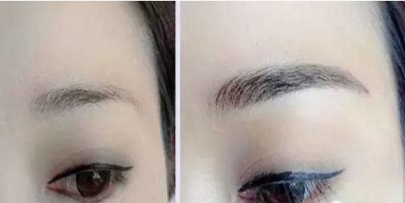 上海最受醫(yī)生推薦的醫(yī)美中心，瑞金整形項(xiàng)目?jī)r(jià)格公開(kāi)！